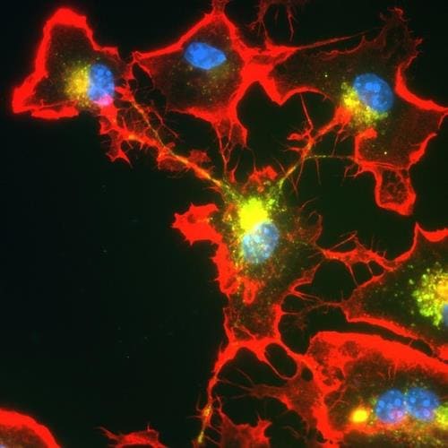 노년기 규칙적 운동이 인지 기능 저하를 막는 메커니즘 Exercise Alters Brain Chemistry to Protect Aging Synapses