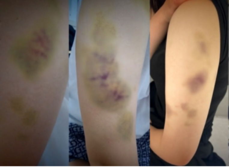 태권도코치-여고생폭행