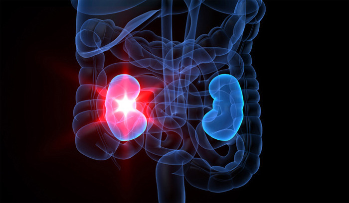 신장 콩팥에 좋은 음식