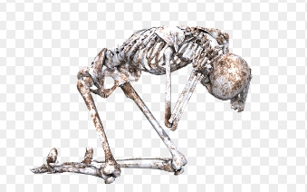 골다공증에 의한 골절 위험성