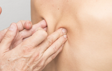 도수치료 비용부담 증가