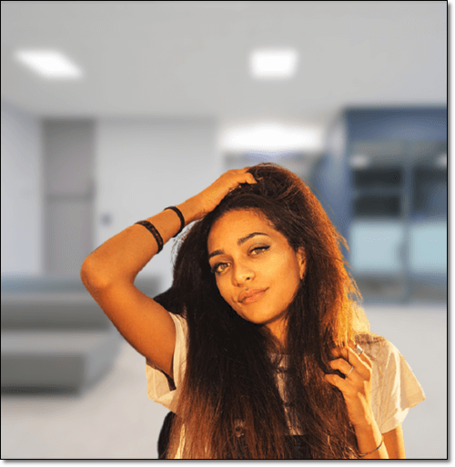 간 질환으로 인한 황달 여성