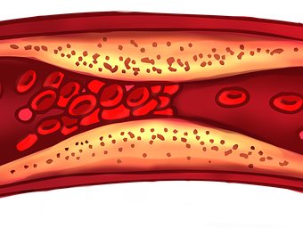 카무트 효소 효능
