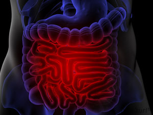 대장암 초기증상