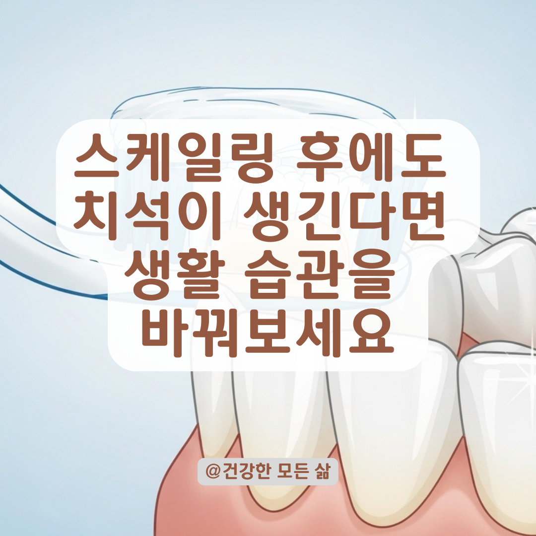 스케일링 후에도 치석이 빨리 생긴다면? 주기 관리와 예방법 총정리.