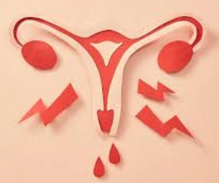 관계후 배앓이 얼얼함 아랫배 통증 복통 이유 6가지 | 관계후 다음날 출혈 의미