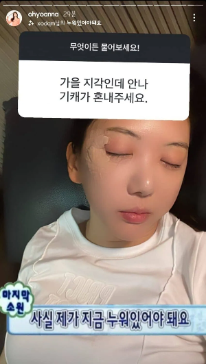 오요안나 얼굴부상 디시