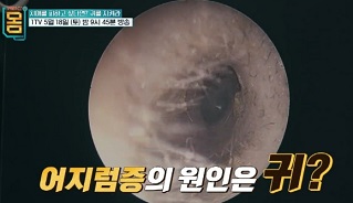 어지럼증원인은귀