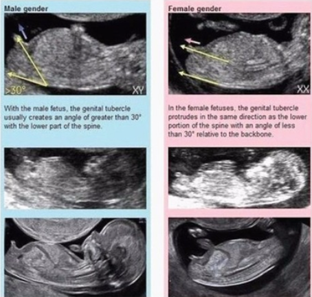 셋째 엄마가 경험해본 온갖 태아 성별 확인 방법 썰(각도법, 심박수 소리, 베이킹소다, 난황위치, 중국황실달력, 첫니개수)