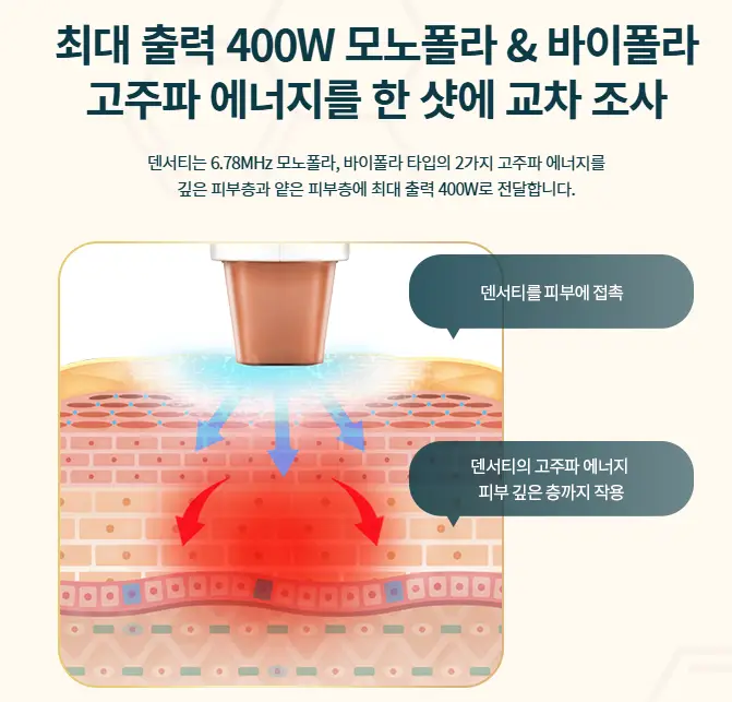 라덴서티-고주파-모노폴라-바이폴라