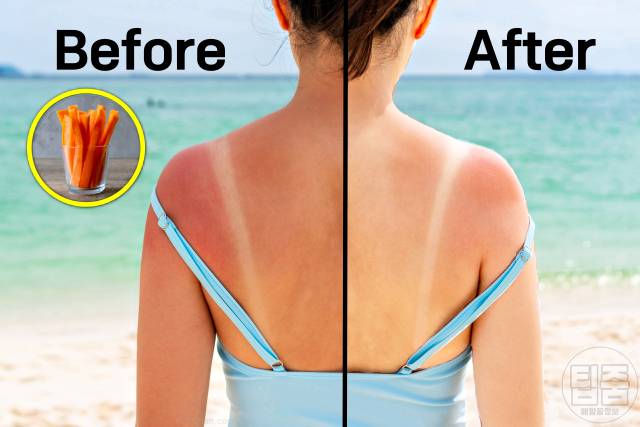 피부 탔을때 하얗게 얼굴 탄거 복구 음식 당근