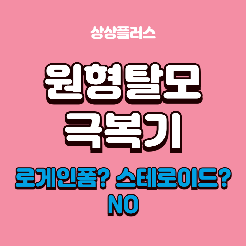 월형탈모 극복기. 썸네일