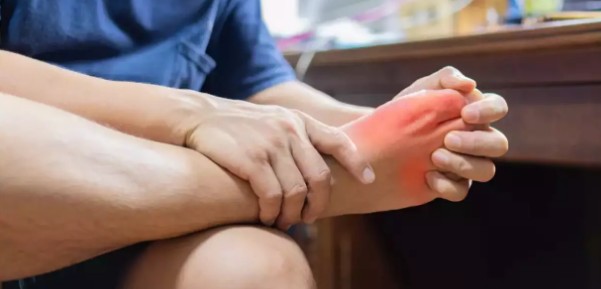 [건강정보] 요산수치 높으면&#44; 낮으면&#44; 요산수치 낮추는법&#44; 요산배출