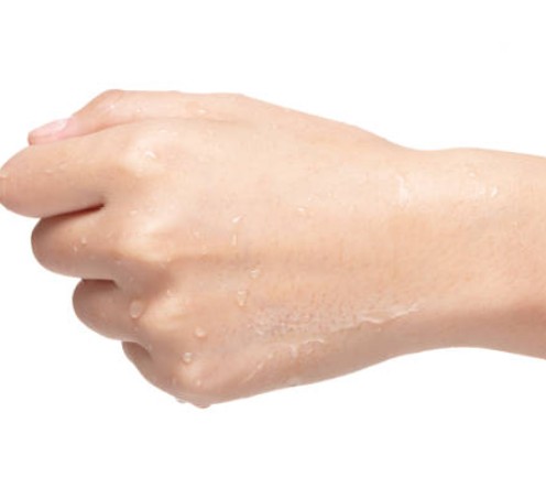 한국인 다한증 발생률과 원인