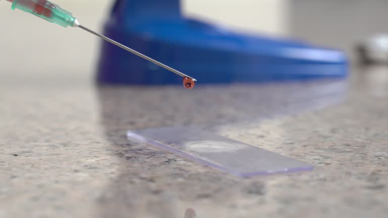 여포암 진단 방법