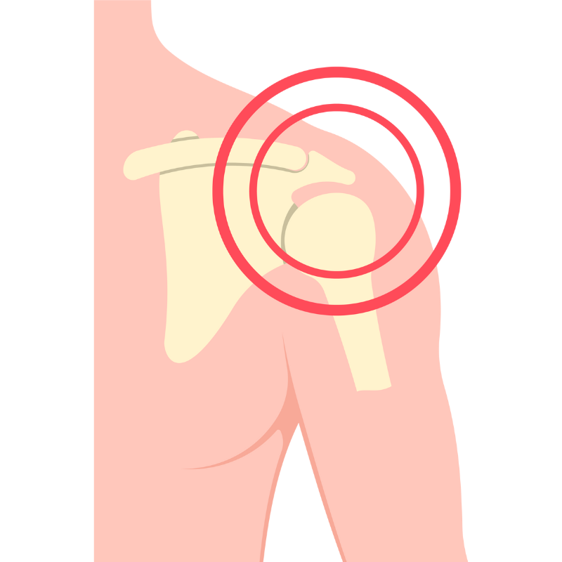 어깨 통증 원인 증상 치료법