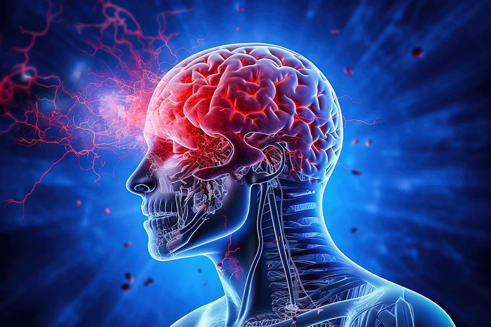 뇌졸중 전조증상