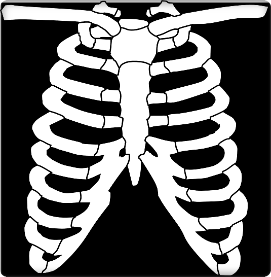 왼쪽 갈비뼈 아래 통증3