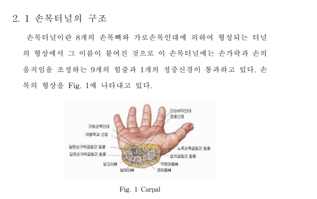 손목터널증후군 부위 증상, 치료 및 예방방법
