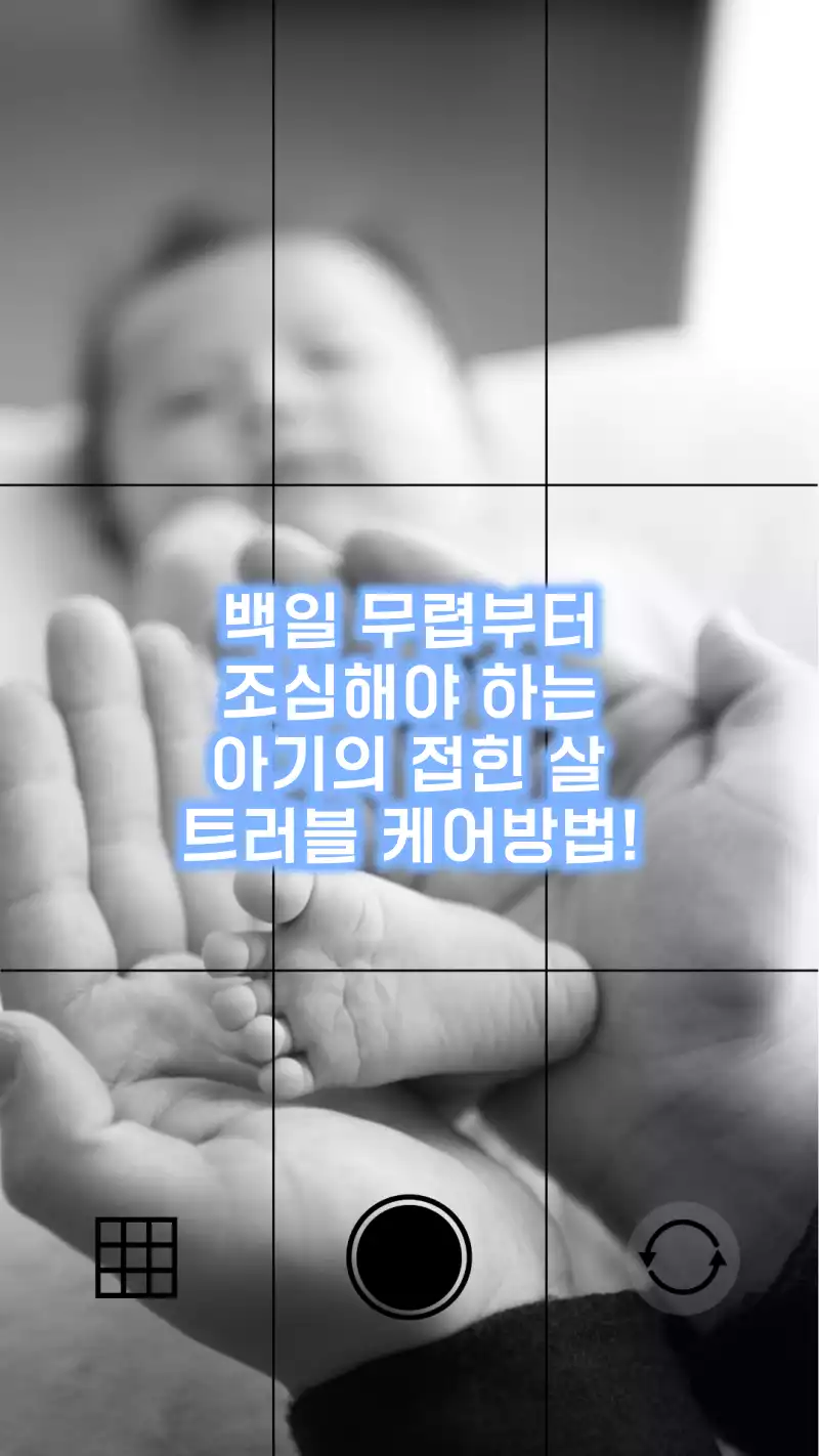 아기의 접힌 살 트러블 케어방법