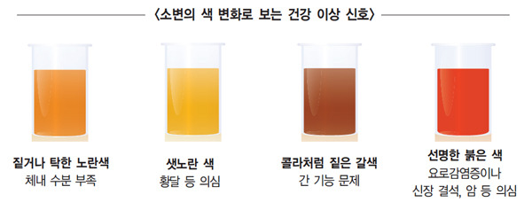소변색 변화로 보는 건강 이상 신호