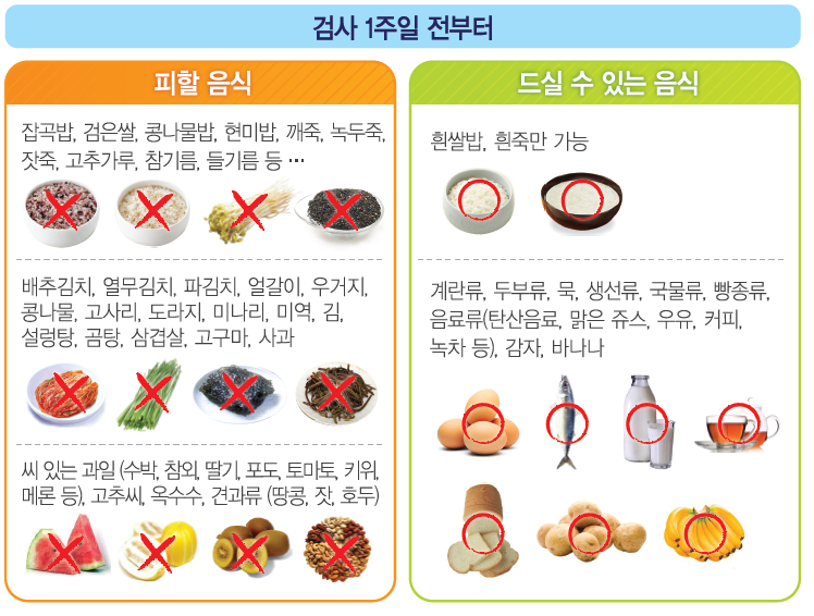 대장내시경 전 음식주의사항 먹어도 되는 음식 전날 음식