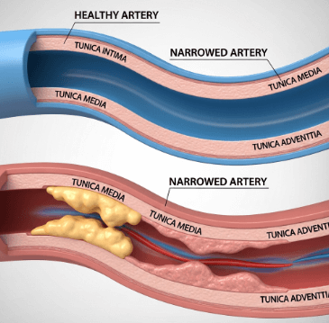 50대 혈압 정상수치 완벽정리4
