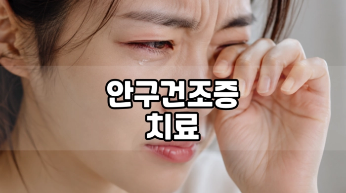 안구 건조증 치료