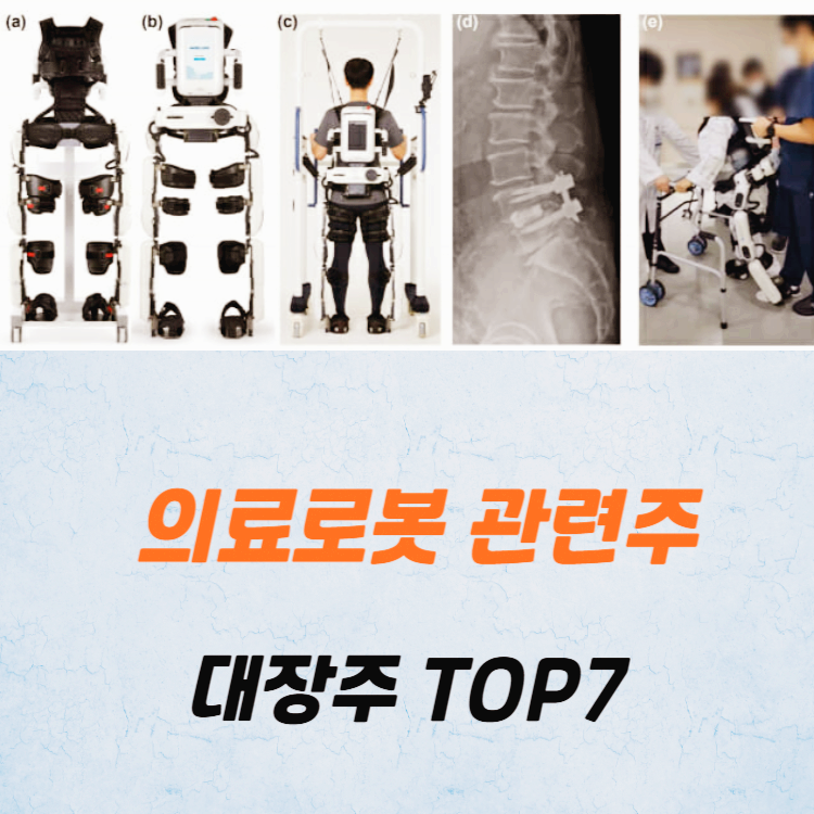 의료로봇 관련주 대장주 테마주 TOP7 주식