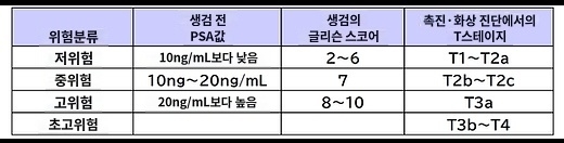 전립선암 소선원치료