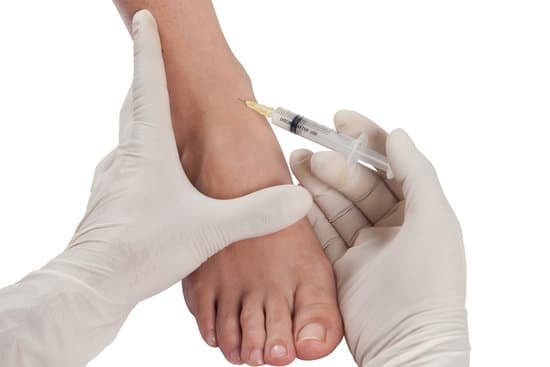 족근관 내 스테로이드 주사