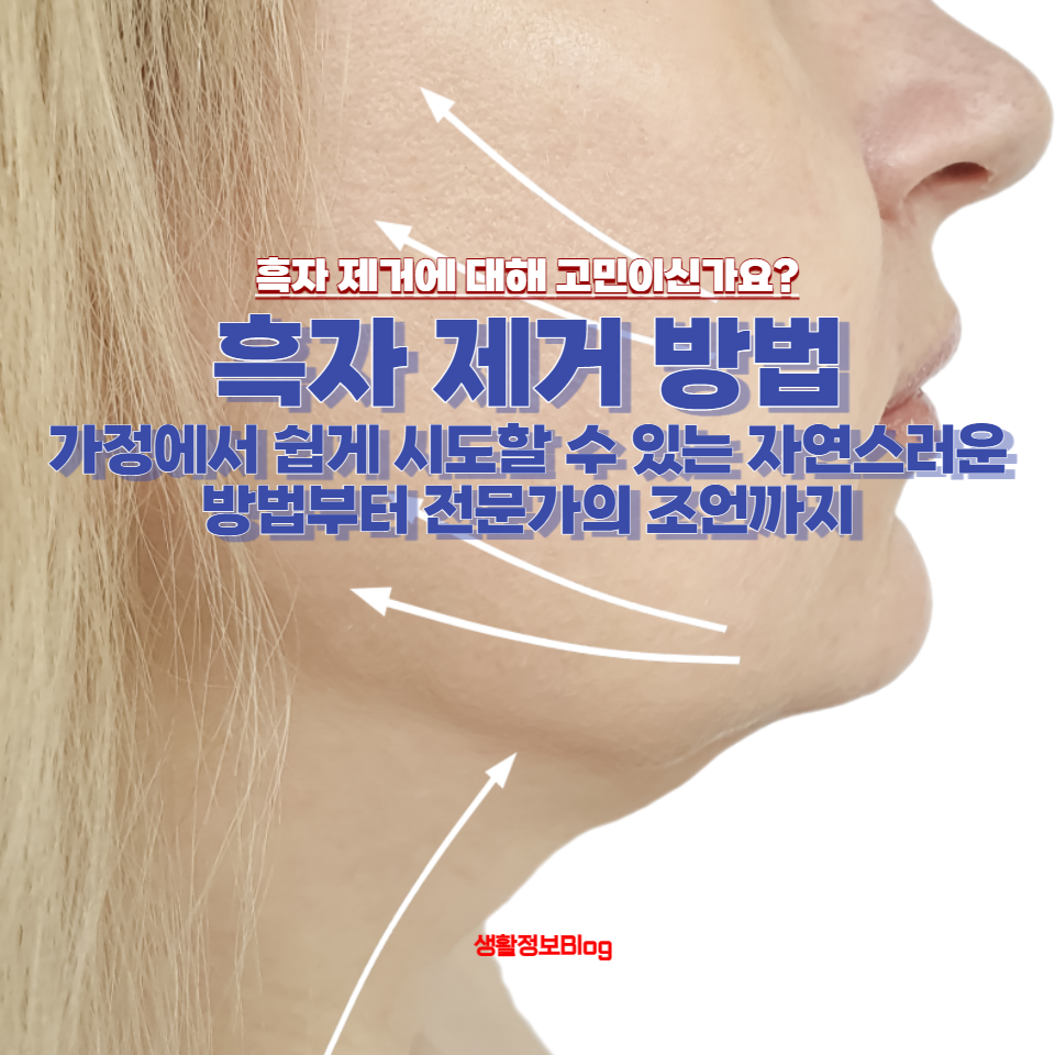 흑자 제거에 대해 고민이신가요?