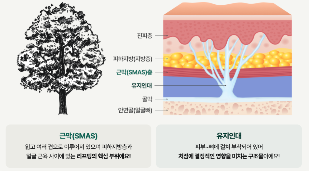 서울리팅성형외과 이중턱살제거