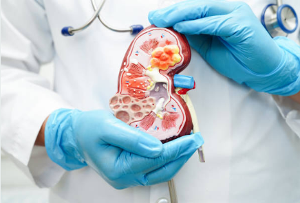 만성 신우신염의 원인과 증상, 진단, 치료와 예방 방법, 합병증