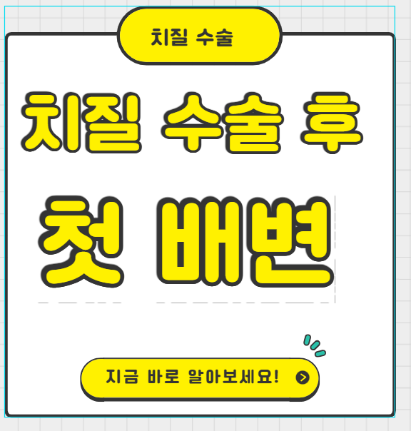 치질 수술