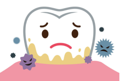잇몸 질환 그림