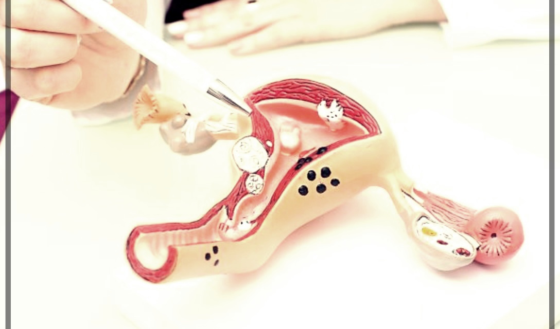 자궁경부 비정형세포 치료및 예방법은?