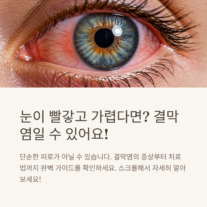 결막염 증상