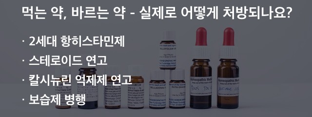 피부 가려움 먹는 약, 바르는 약 - 실제로 어떻게 처방되나요?