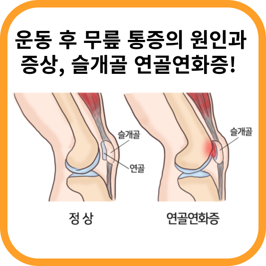 슬개골 연골연화증