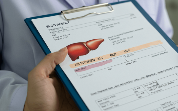 간수치 내리는 방법 관련 사진 3