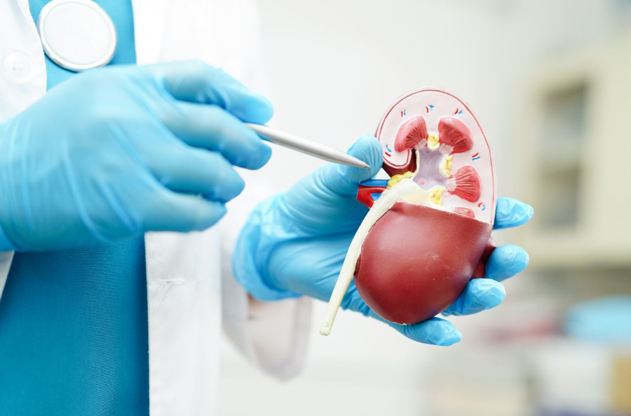 eGFR 형태 이미지