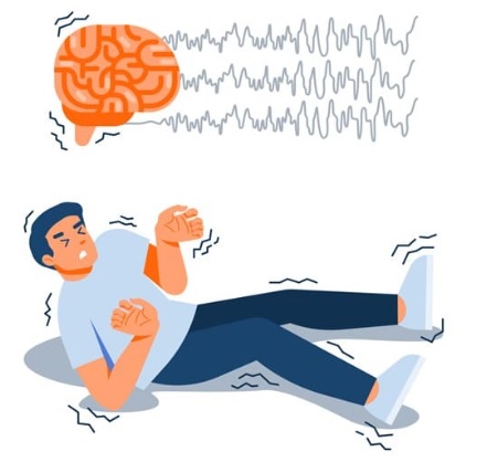 뇌전증(Epilepsy)