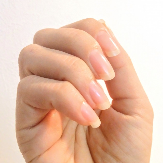 손톱에 세로줄이 생기는 이유