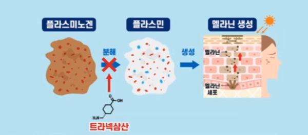 트라넥삼산 효능