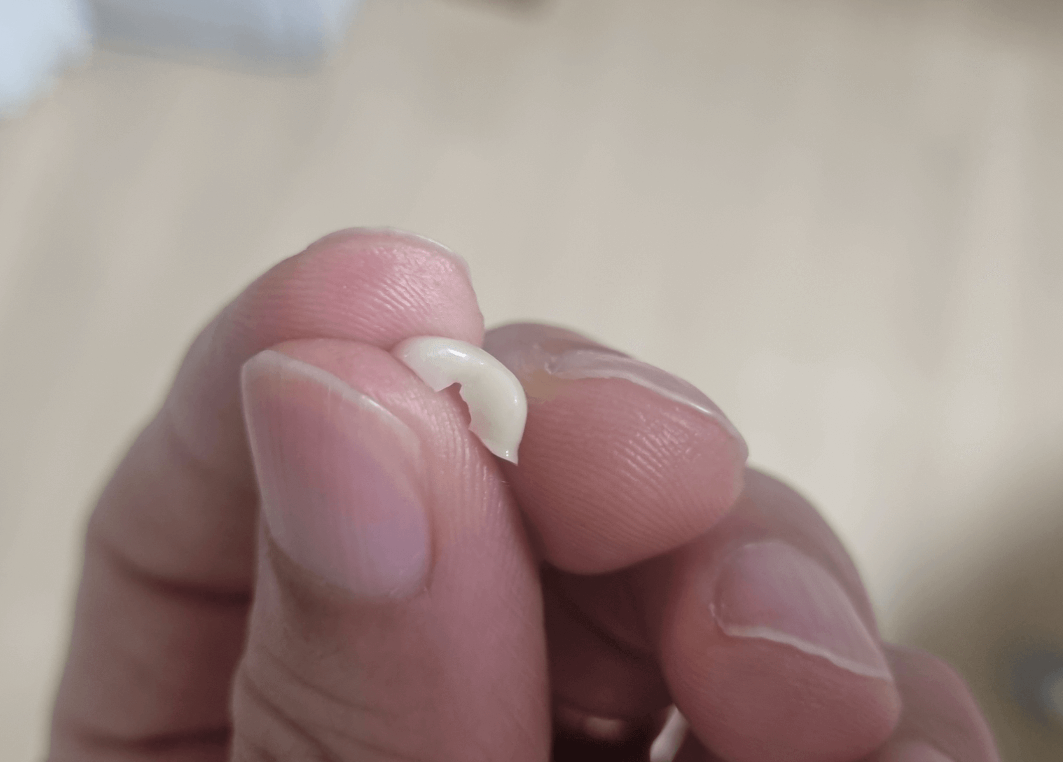 지르코니아 깨짐