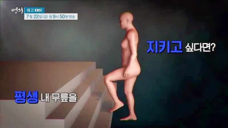 명의 수술 없이 무릎을 오래 쓸 마지막 기회 새 무릎으로 사는 법 치료법 정형외과 인용 교수, 재활의학과 이종인 교수