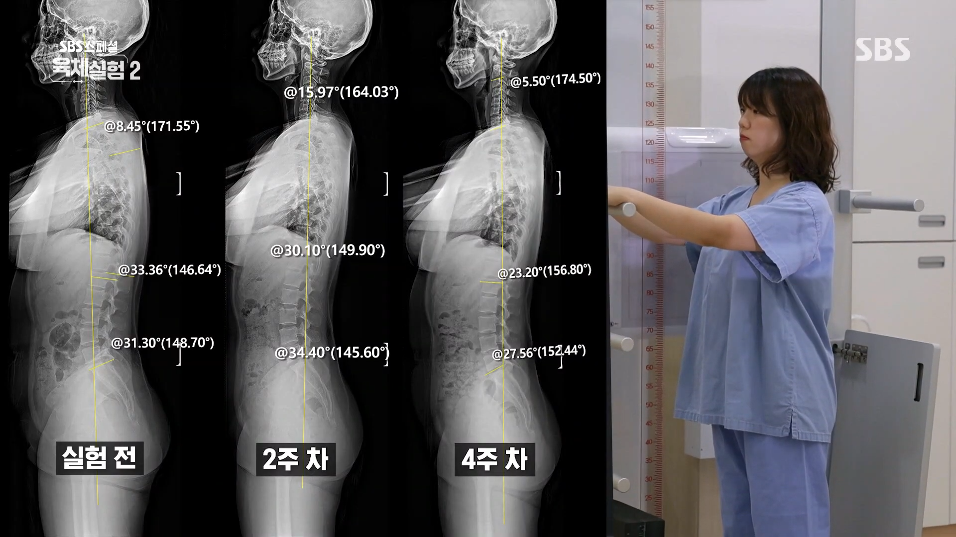 거북목 알림 진동 기계 힐디넥 에그 SBS 스페셜 육체실험 바른 자세