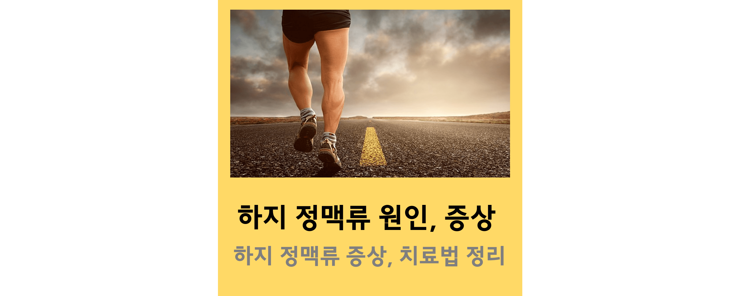 하지정맥류