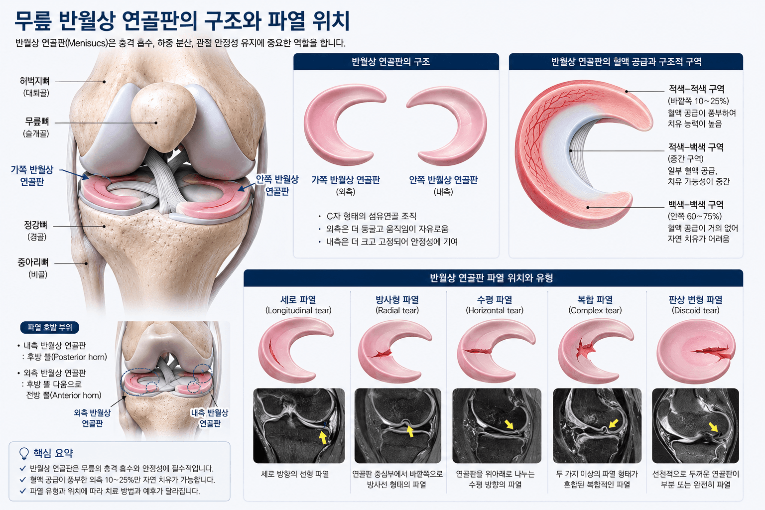 반월상 연골판구조